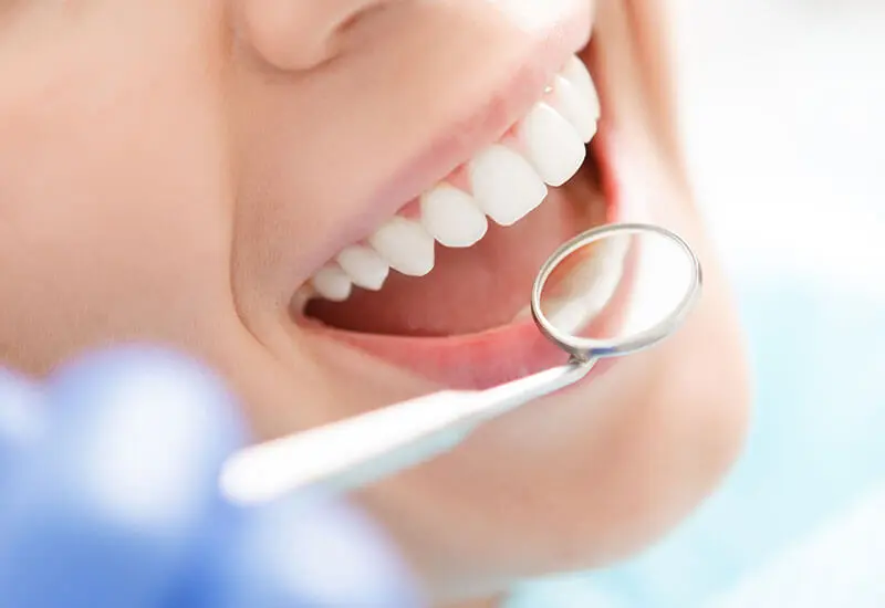 セラミック治療