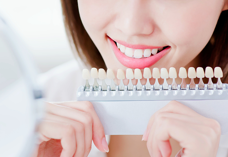 自然な色の歯を得られる