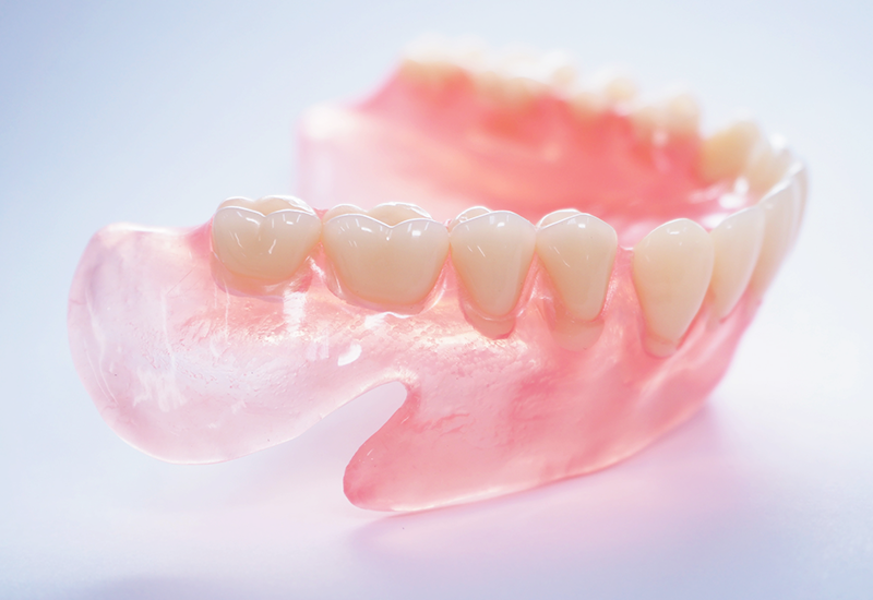 ノンクラスプデンチャー