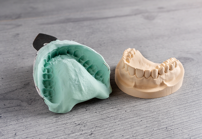 型取り（印象採得）