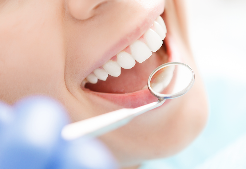 メインテナンス