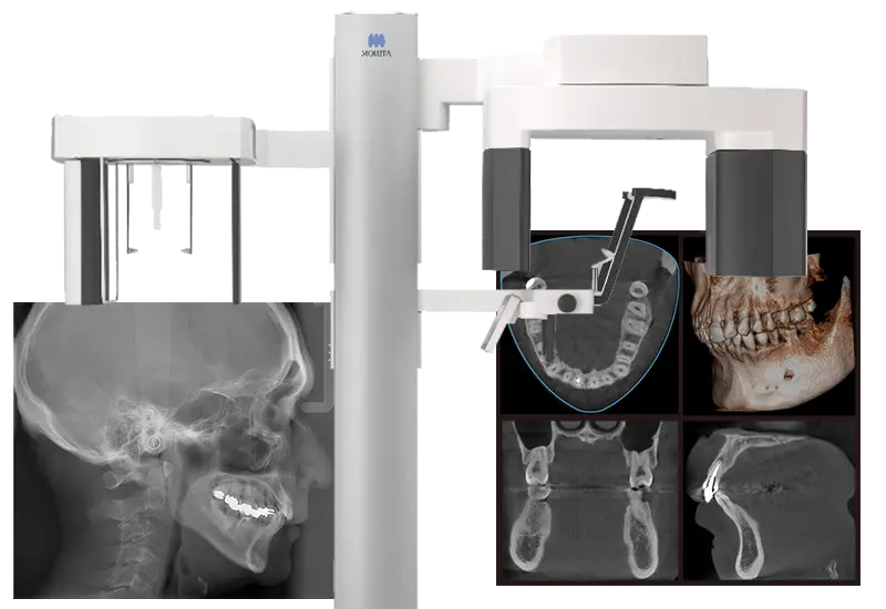 歯科用CT・デジタルレントゲン
