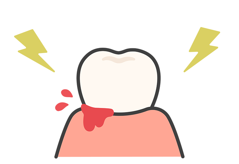 虫歯・歯周病の予防につながる