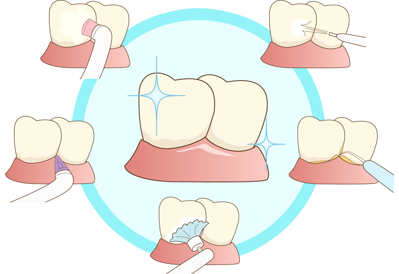 専門的なクリーニング「PMTC」について