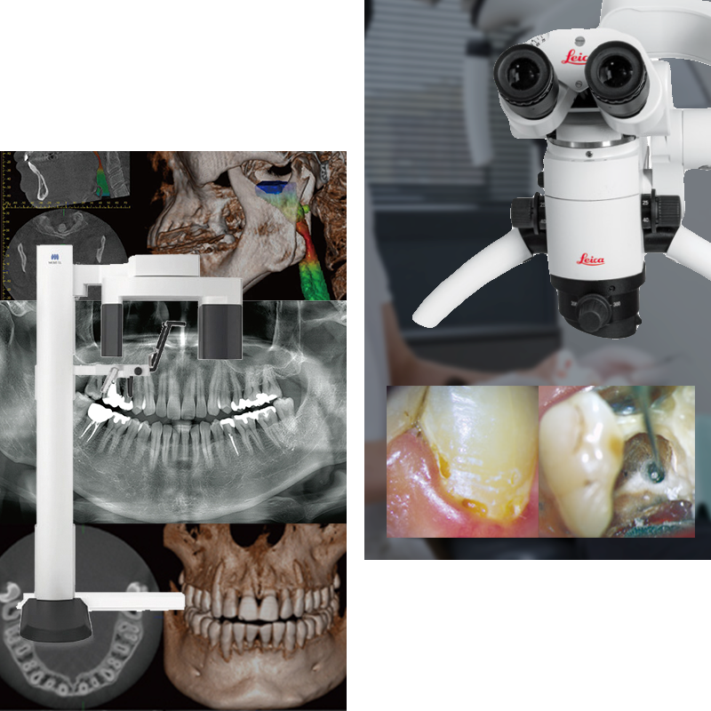 歯科用CT・マイクロスコープ