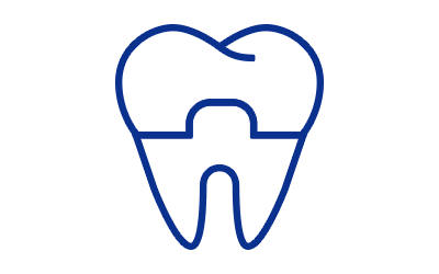 セラミック治療